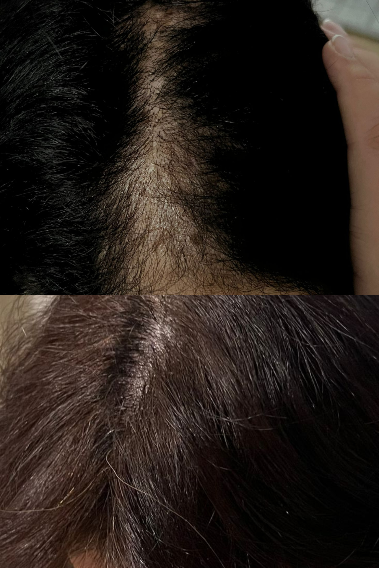 ULTIMATE HAIR GROWTH FORMULA