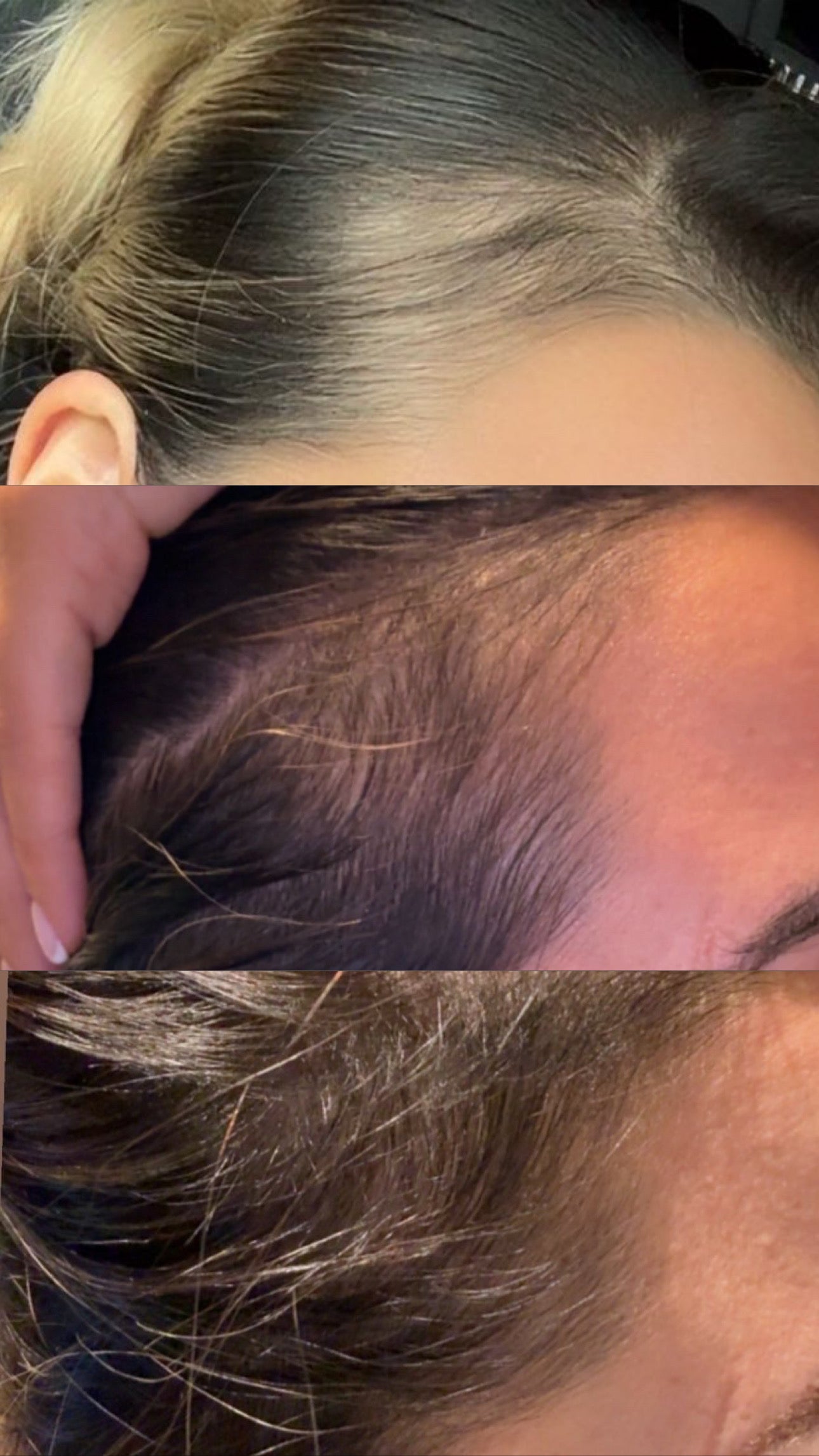 ULTIMATE HAIR GROWTH FORMULA