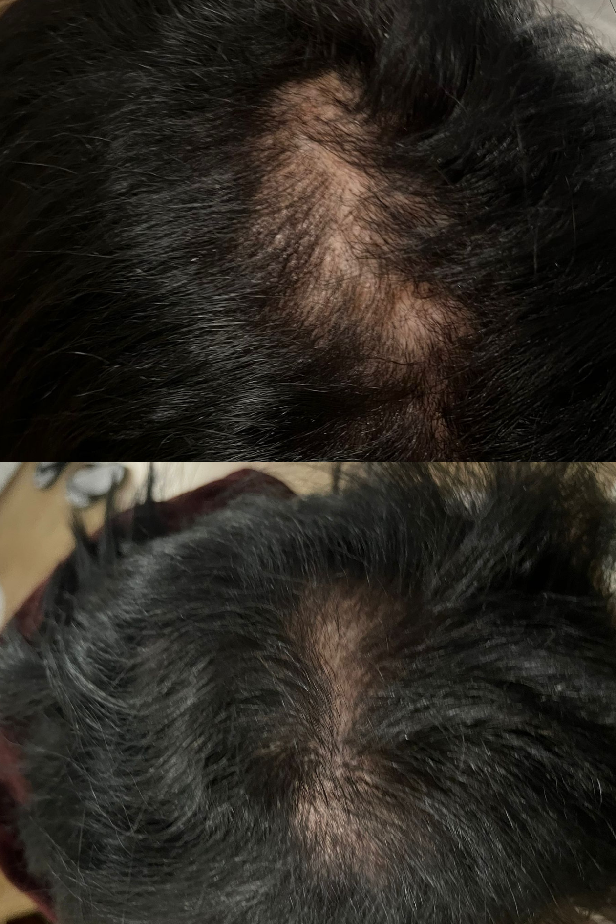 ULTIMATE HAIR GROWTH FORMULA