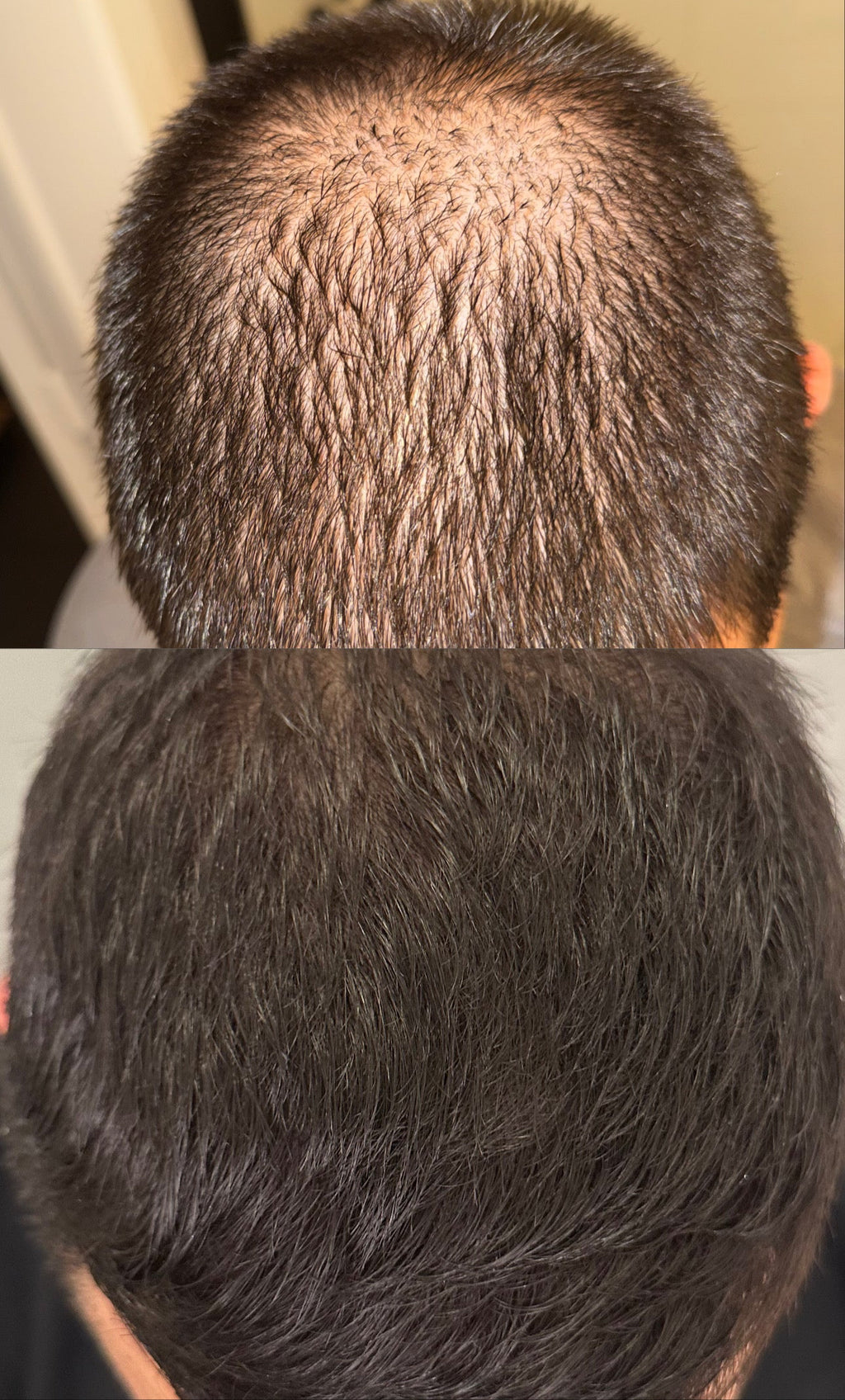 ULTIMATE HAIR GROWTH FORMULA