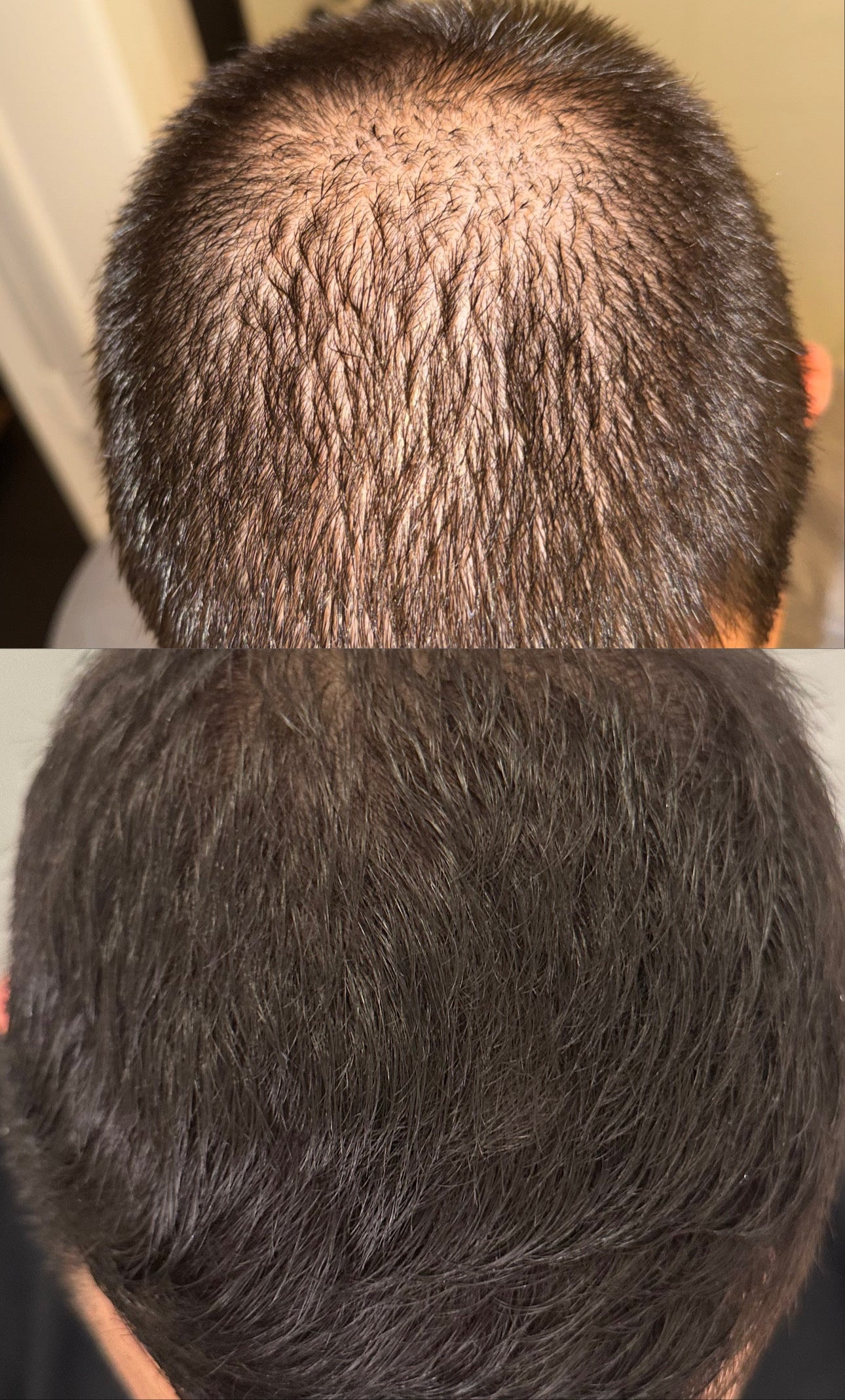 ULTIMATE HAIR GROWTH FORMULA